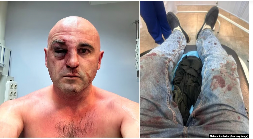 ლევან ხაბეიშვილი