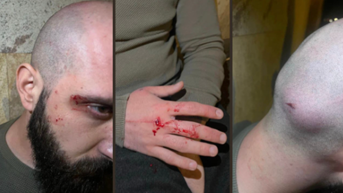 ბორის (ჩელე) ყურუა