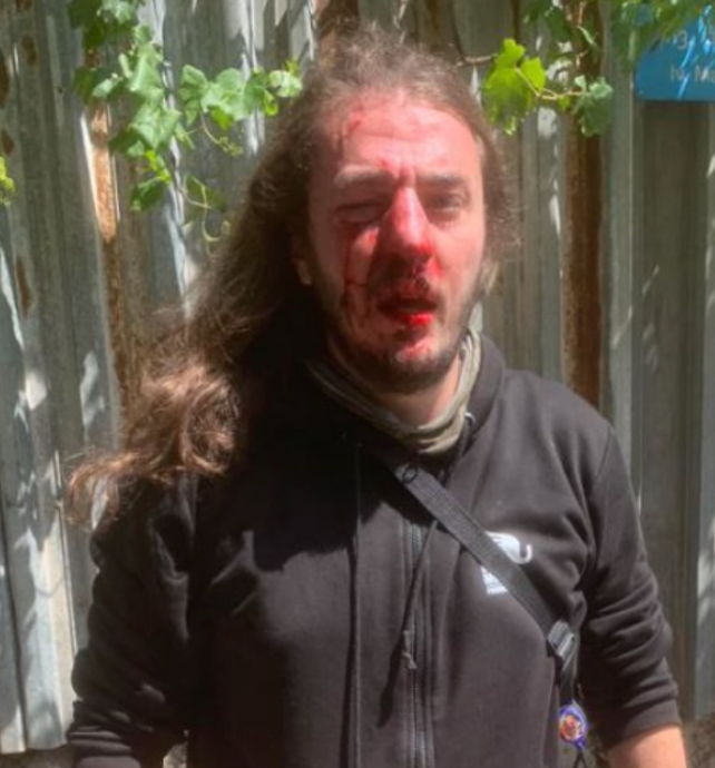 ზურა ბერძენიშვილი