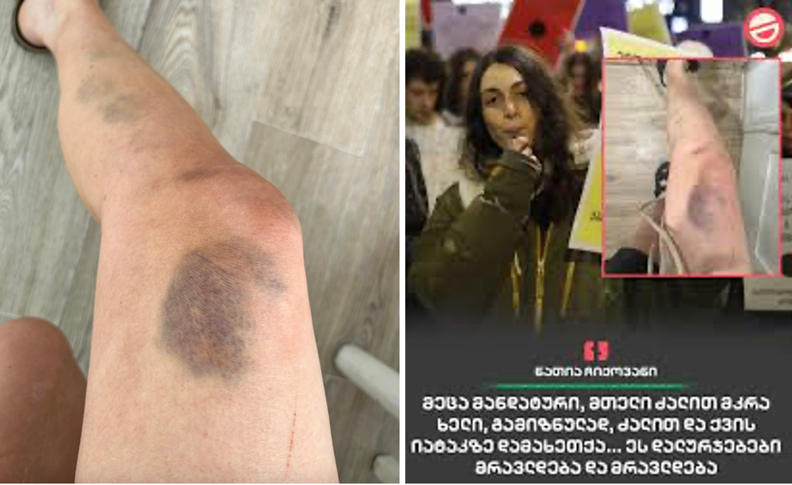 ნათია ჩიქოვანი