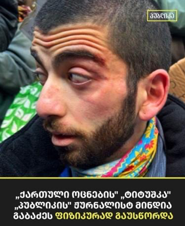 მინდია გაბაძე