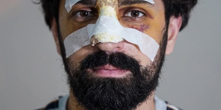 ალექსანდრე ქეშელაშვილი