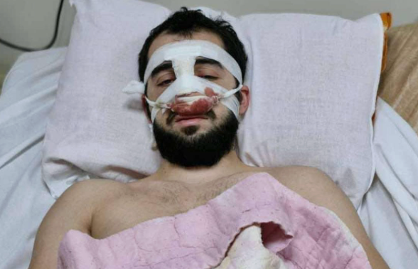 ავთანდილ ტიტვინიძე