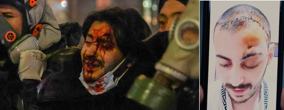 ალექს თირქია