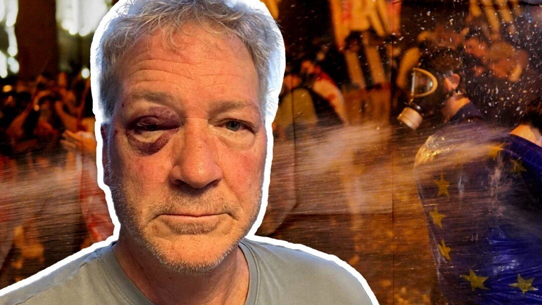 ტედ ჯონასი