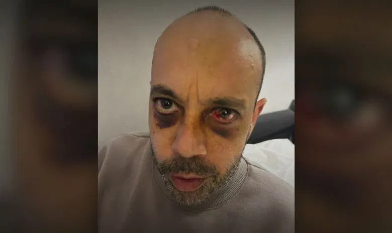 დერილ შოლცი